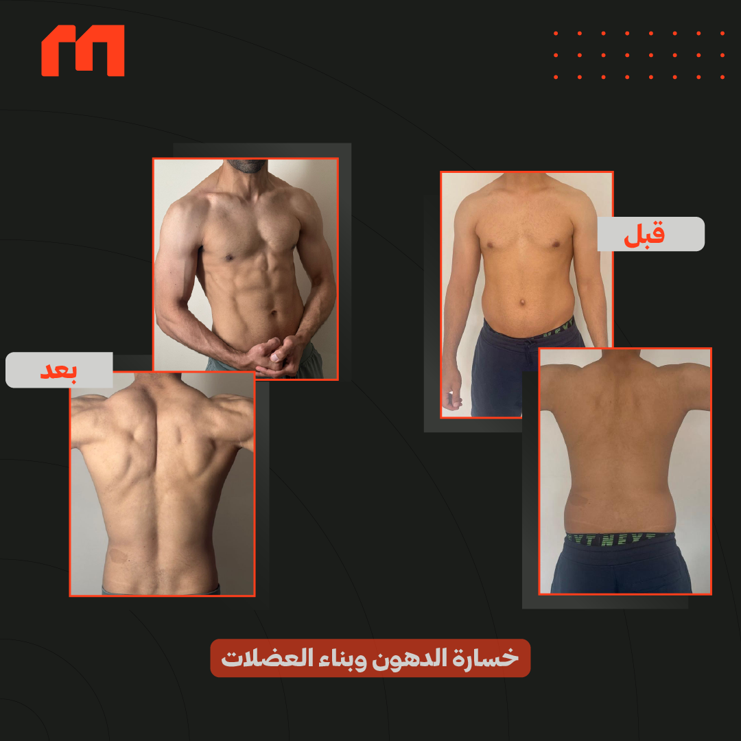 B4&After (1) (1) (1)