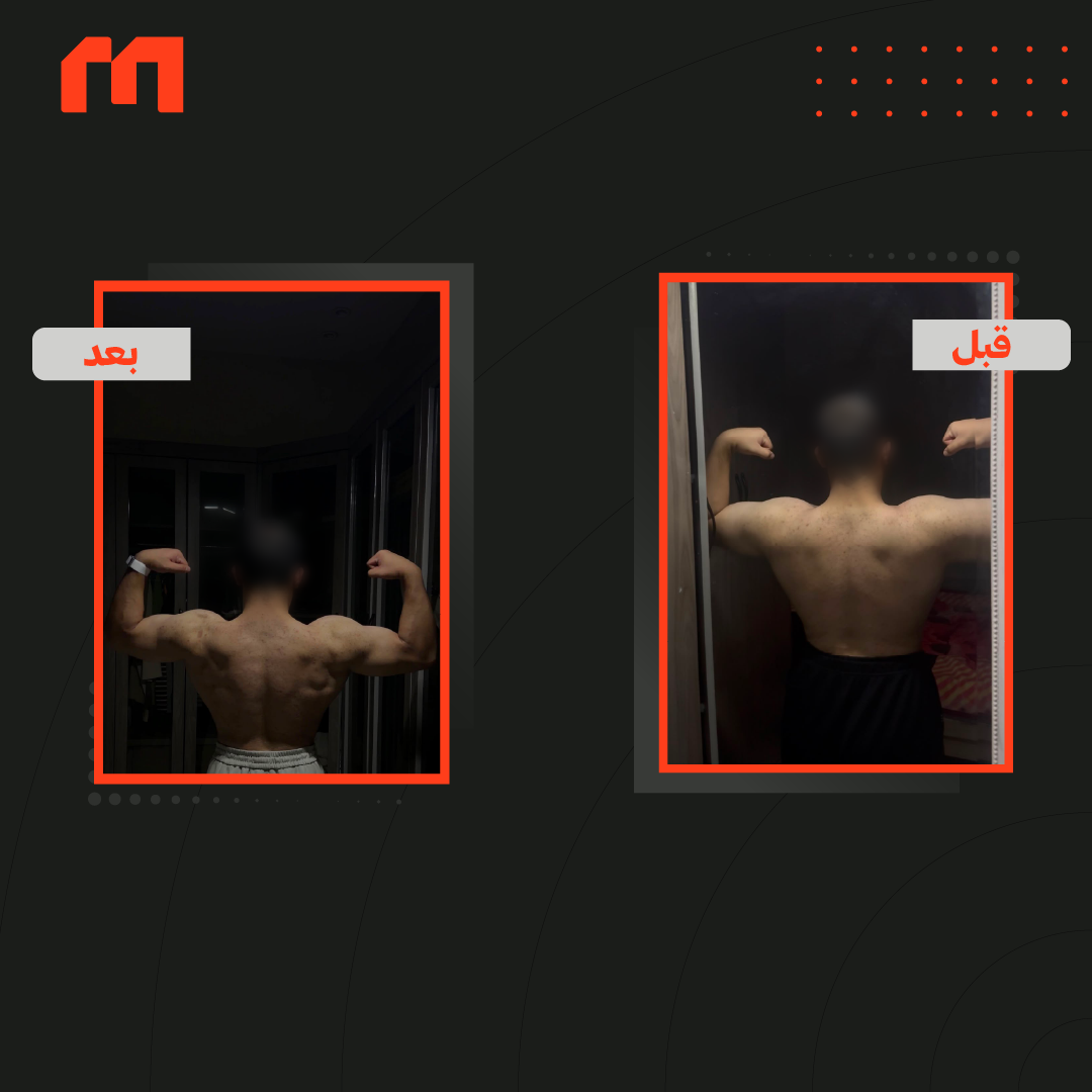 B4&After (1) (1)